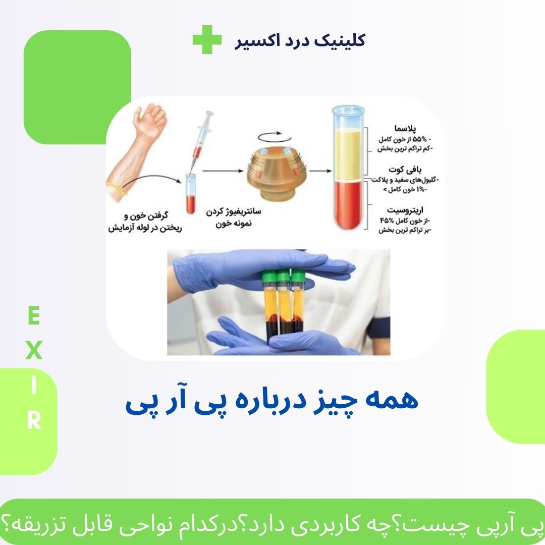 همه چیز درباره پی آر پی